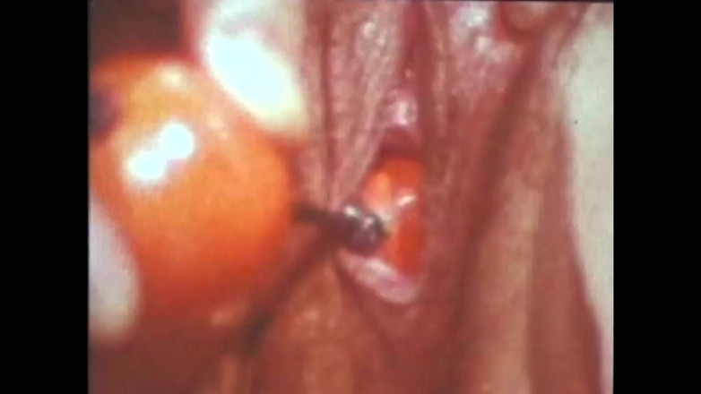 The Unforgettable: Ванесса і Марлен грають з м'ячами