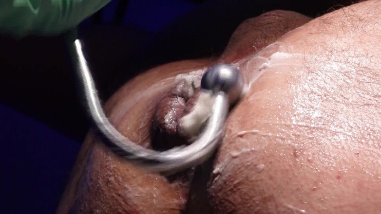 Marcus Pollack: Absolute Anal Treatment