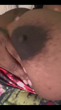 25460764