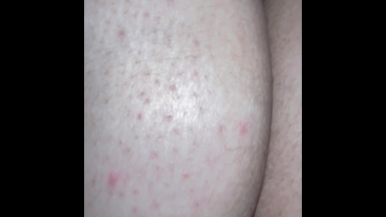 Hard: Dikke kont veerassemblage