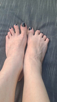 Do We See How Beguiled My Throbbing Foot Veins Are