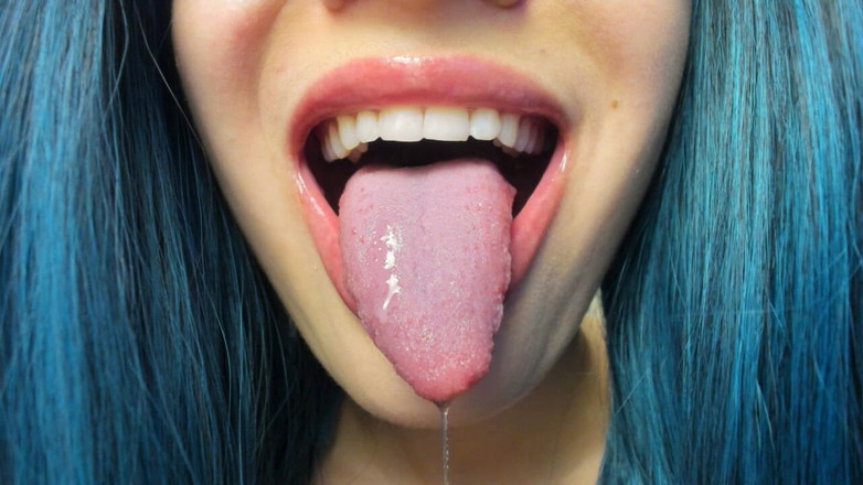 Rarible Diamond: Z jazyka mi kape slintá slintá