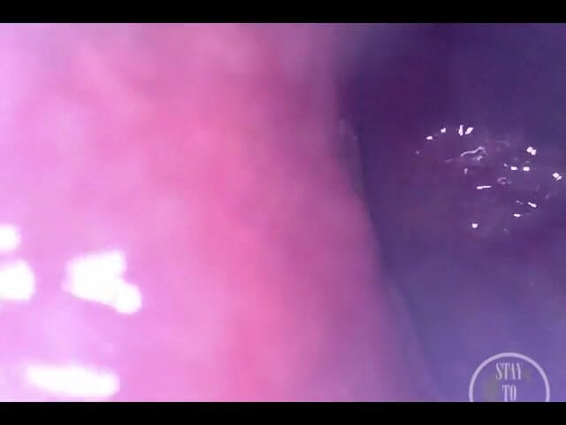 Lina Free: POV Extreme Deep Anal Examination!
