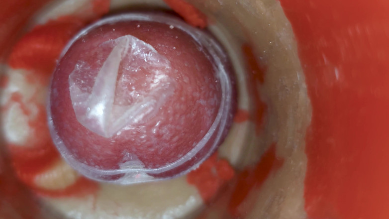 Creme sperm: Un Flusso Incontrollabile Riempie La Figa Con Un'infinita Pressione Interna