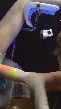 1st. Uv-neon Light Anal Fisting Experience of Adelina Noir and Fistdude
