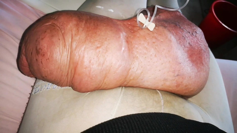 Monster_Meat_: Kolejna ogromna infussion