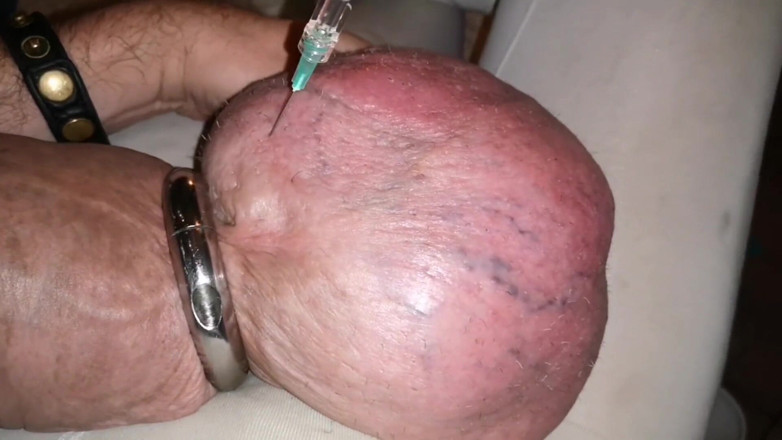 Monster_Meat_: Riempio di glucosio 1litro