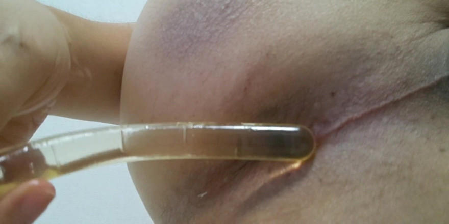 Tomoooi: Anal Play with Toys