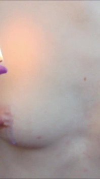 Hot Wax pada Puting
