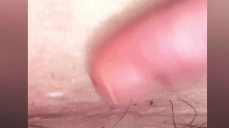 SatisfyingDillyDally: Me arrancando