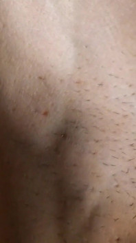 Abs Veins