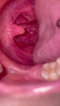 Mouth Tour Flash on Deep Inside My Mouth