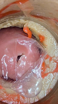 La Cámara 4K Dentro Del Coño Profundo Graba Una Enorme Eyaculación Con Un Condón Atascado