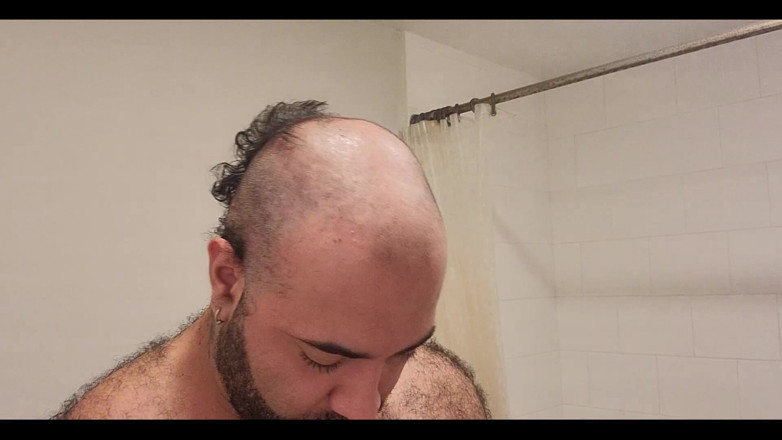 Lobo: I Finally Got Rid of the Head Hair