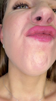 Mouth Secrets: Thick White Coating on My Tongue