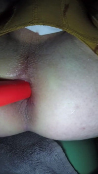 Peregangan anal