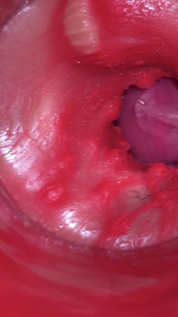 Camera Inside Pussy: Powerfull Cum in Pussy! Best Internal Asmr in 4K More Sperm