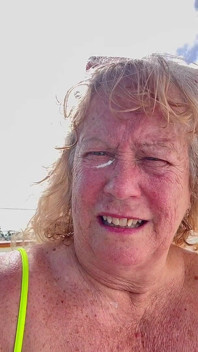 Putting Sunscreen on Every Last Freckle
