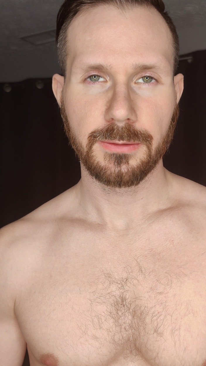 Albino Adonis: Welcome