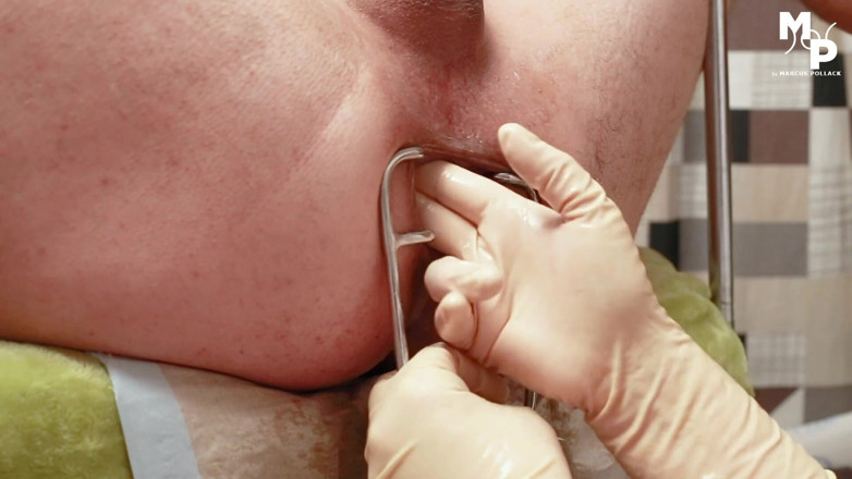 Marcus Pollack: Speculum si allunga per il buco del sottomesso