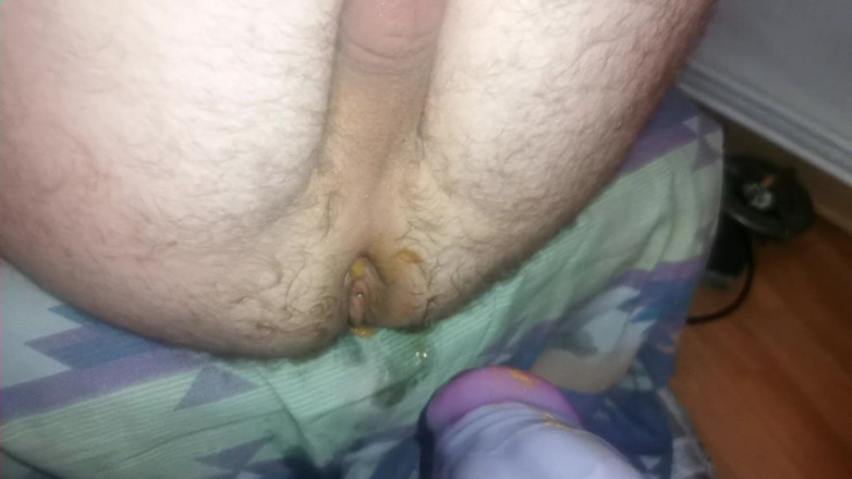 Fuck machine massaker: Enorme dildo culo dilatato