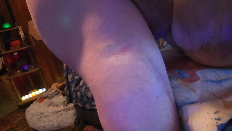 Gussfuss: L'anno in Bondage 15