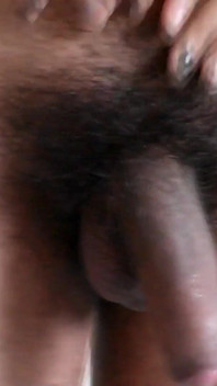 Penis Hair Removal with Several Hairs