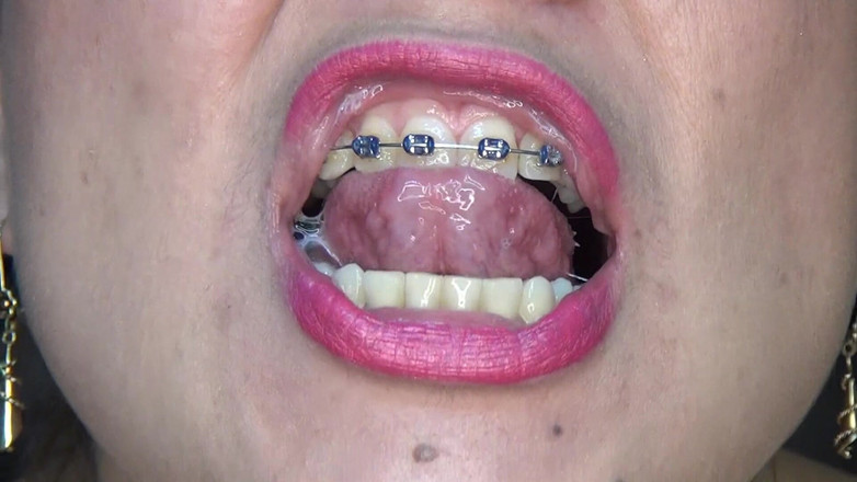 Angel eyes studio: Deglutizione di enormi mandorle senza sosta!!