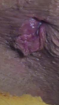 Pushing Out a Creampie