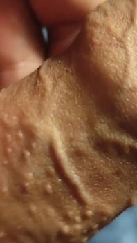 Exploding Veins with Rough Grandpa Oil.