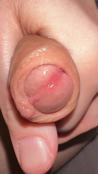 @jerkbuddy Jerking My Wet Uncut Cock