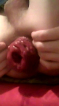 A Young Hot Guy Sitting on a Chair Shows His Anal Prolapse