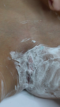 Depilazione delle fighe pelose con una schiuma da depilazione da vicino!