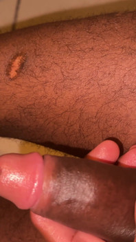 Habesha Dick