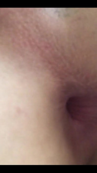 My hole today