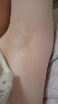 Elza kom adorazione dell'ascella