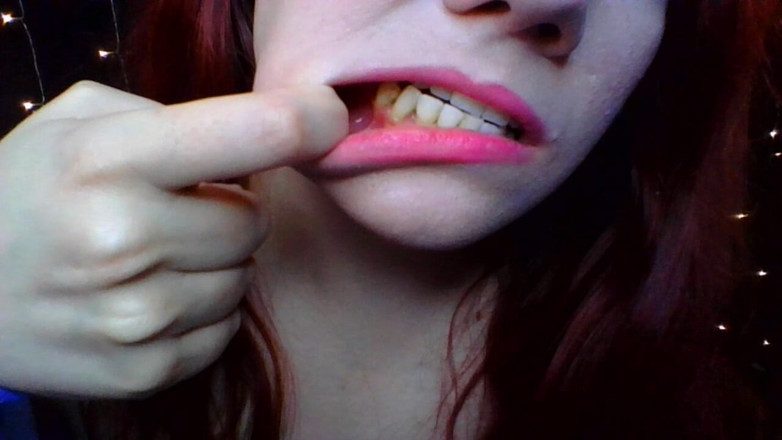 Scarlet Vixen: Dentes, obturações e fetiche pela boca