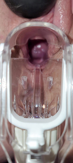 Contraby: Sborrata con speculum cervix orgasmo