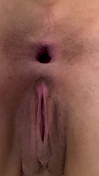 Il buco del culo aperto
