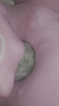 Gaping Hole Under Construction
