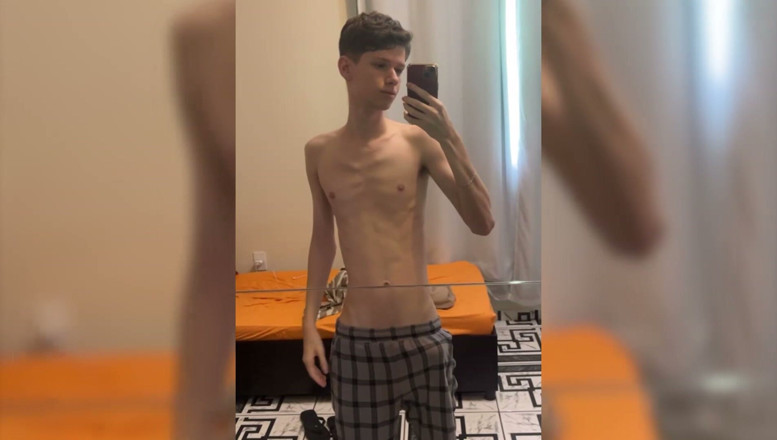 Kedoimath: Skinny Jaw Cracks with Cock Size