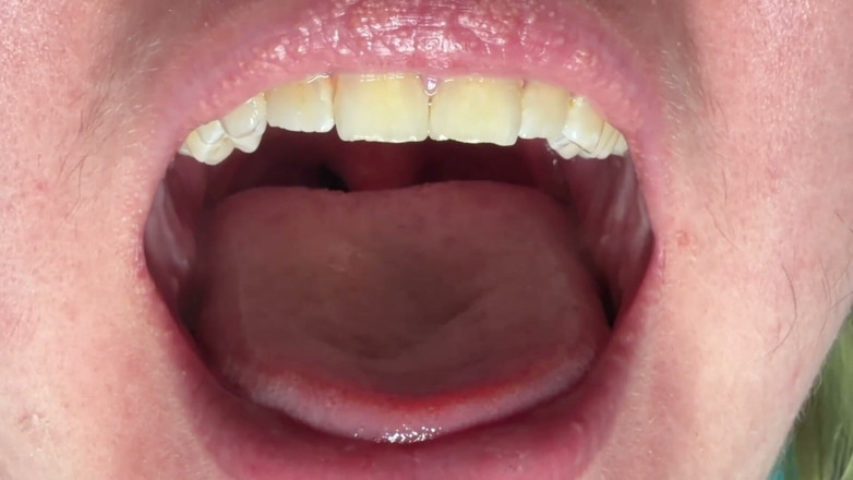 Spunk Kip: Mouth &amp; Tonsils Close-up