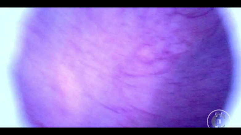 Lina Free: Beautiful Inside POV of My Full Bladder with the Endoscope!