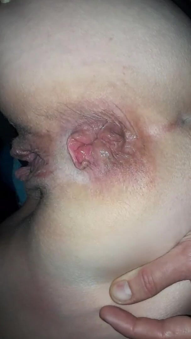 Berlin Couple: 柏林的业余户外肛交