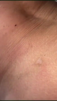 miód B