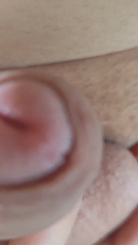 Uncircumcised Big Pink Dick Boy!!!