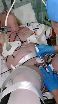 Lisa Essex and Mistress Jane Medical Fetish Electro Play