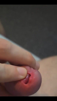 Who Can Help Me with My Raging Hard on