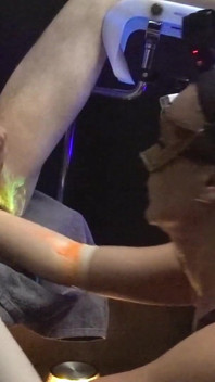 1st. Uv-neon Light Anal Fisting Experience of Adelina Noir and Fistdude