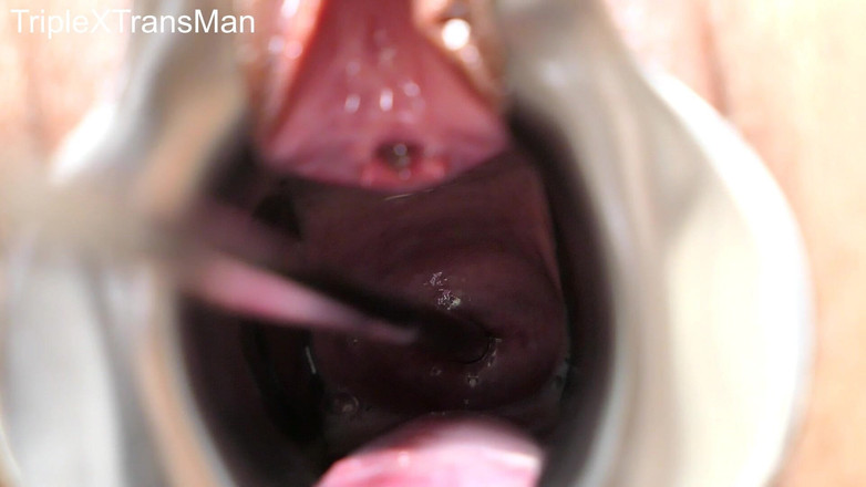 TripleXTransMan: 穿透我的子宫颈！